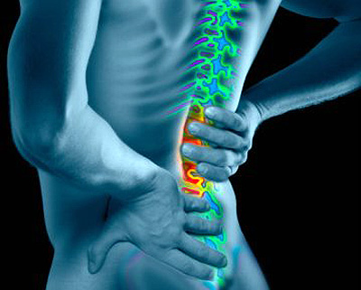 A hidden cause of low back pain - Mather Hospital